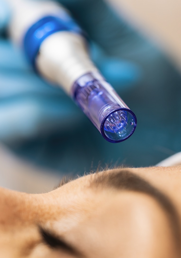 Derma Pen