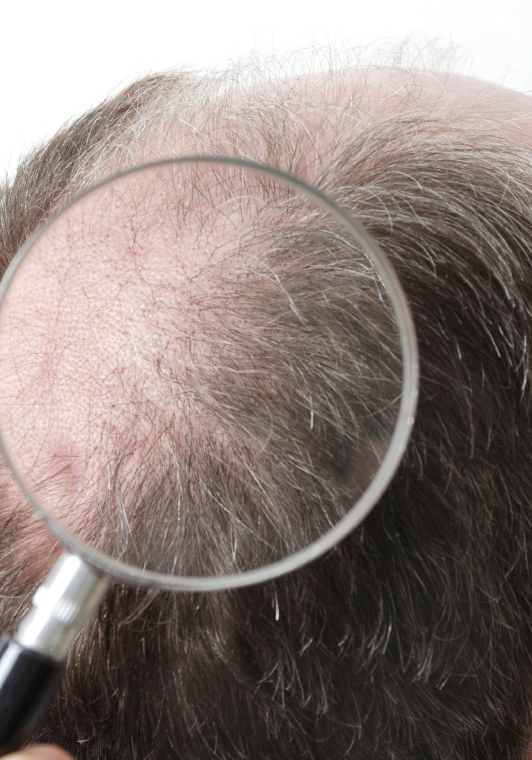 Hair Growth